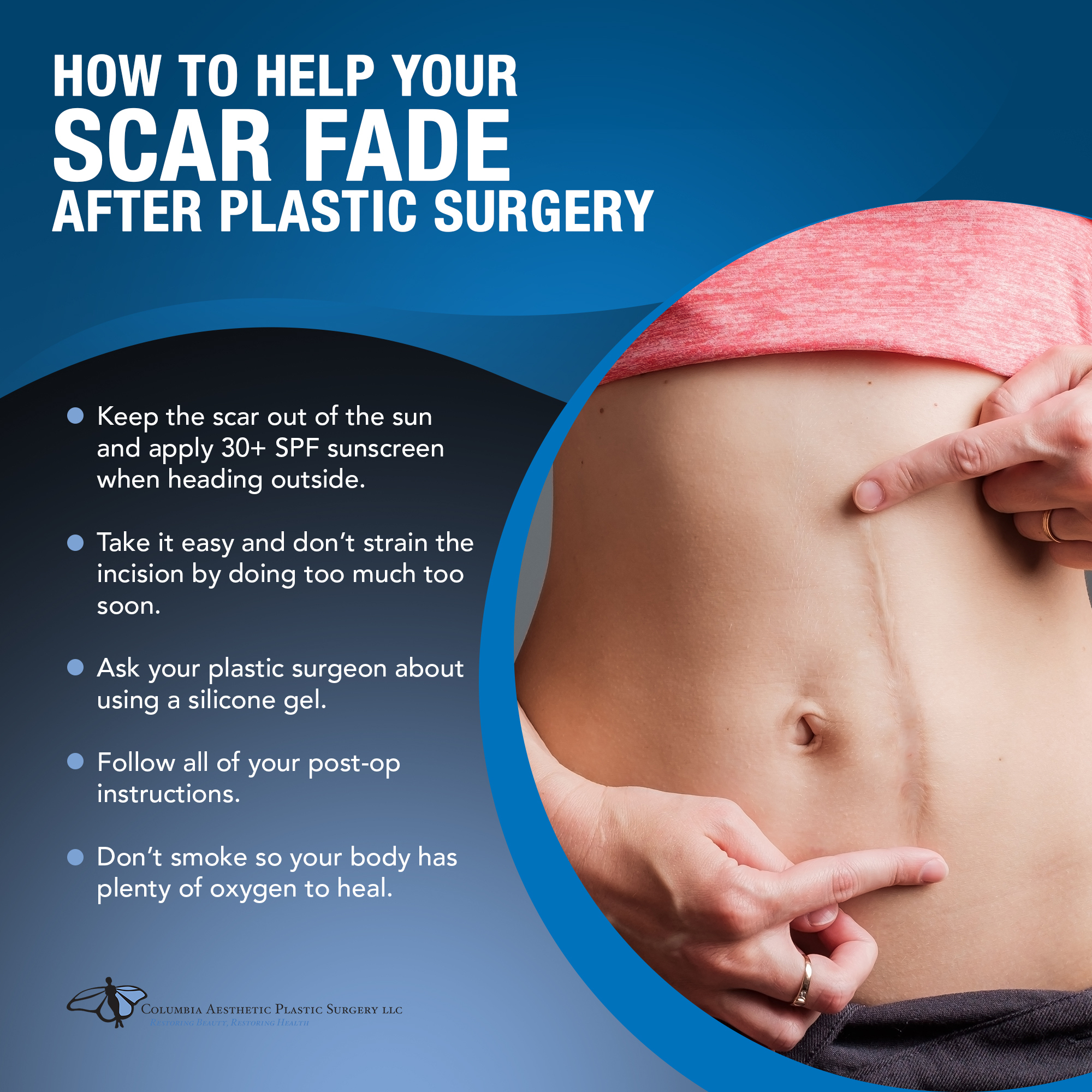 How To Help Your Scar Fade After Plastic Surgery [Infographic]