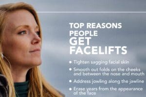 Top Reasons People Get Facelifts thumb