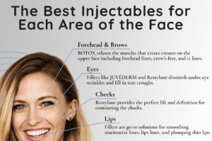 The Best Injectables for Each Area of the Face thumb