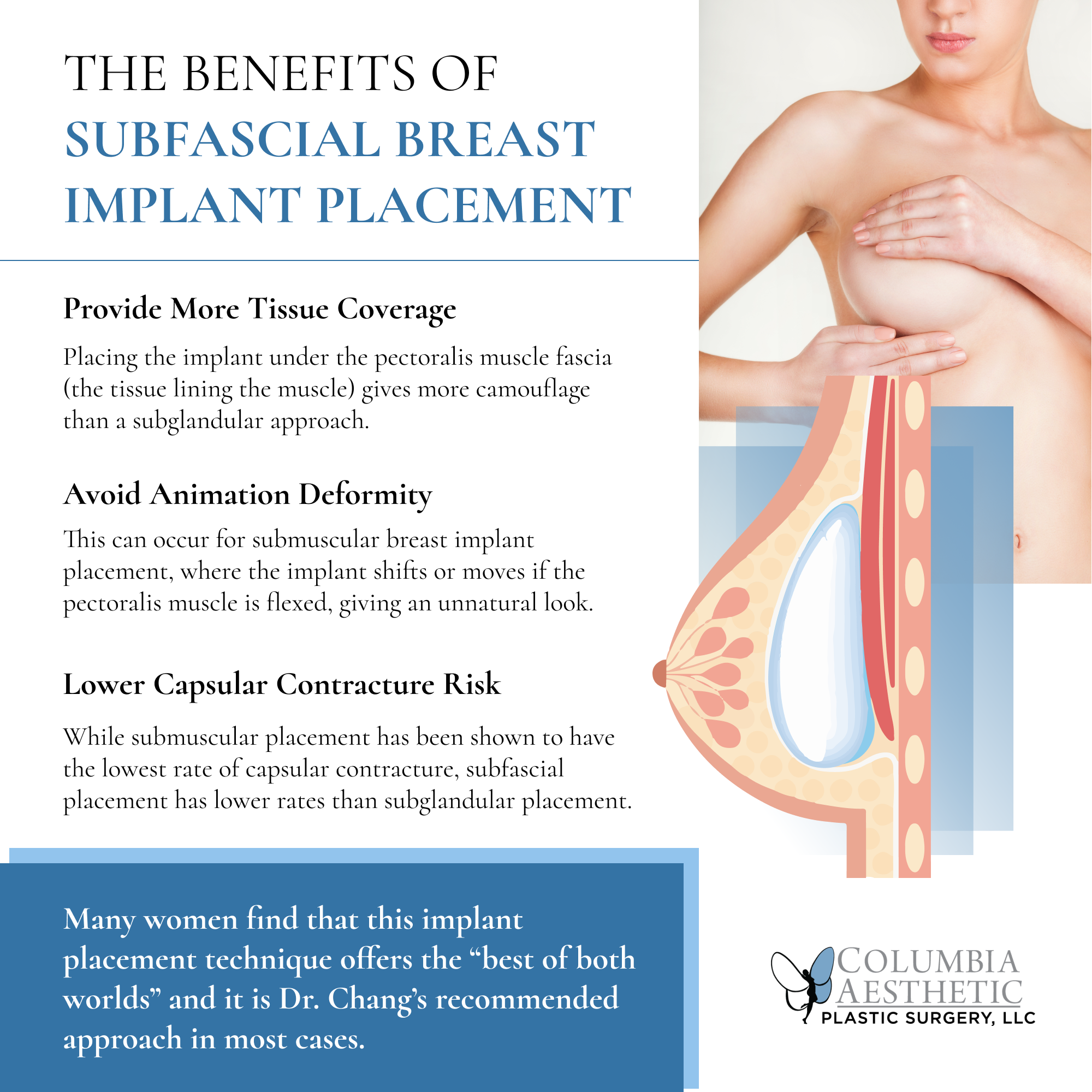 THE BENEFITS OF SUBFASCIAL BREAST IMPLANT PLACEMENT