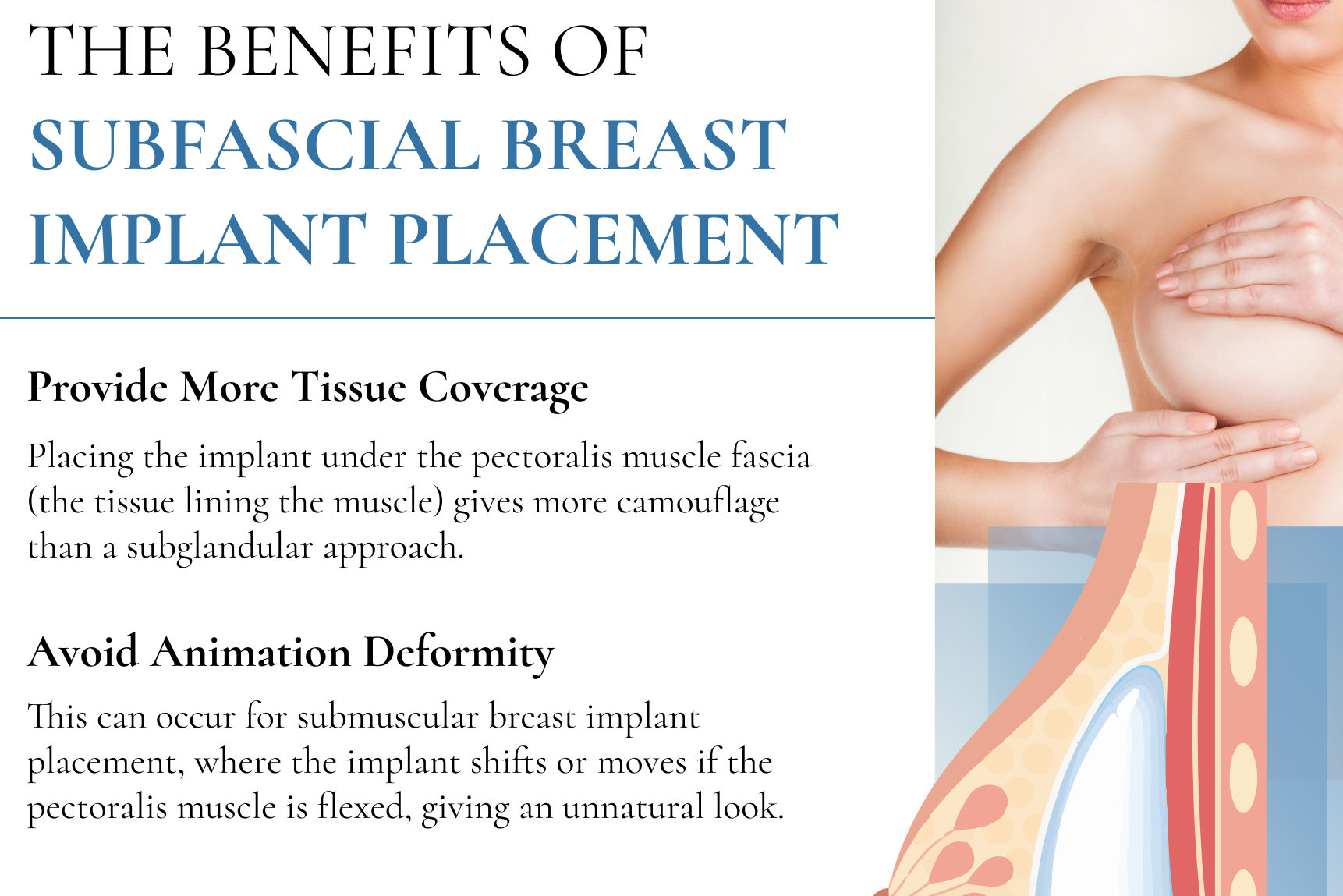 THE BENEFITS OF SUBFASCIAL BREAST IMPLANT PLACEMENT
